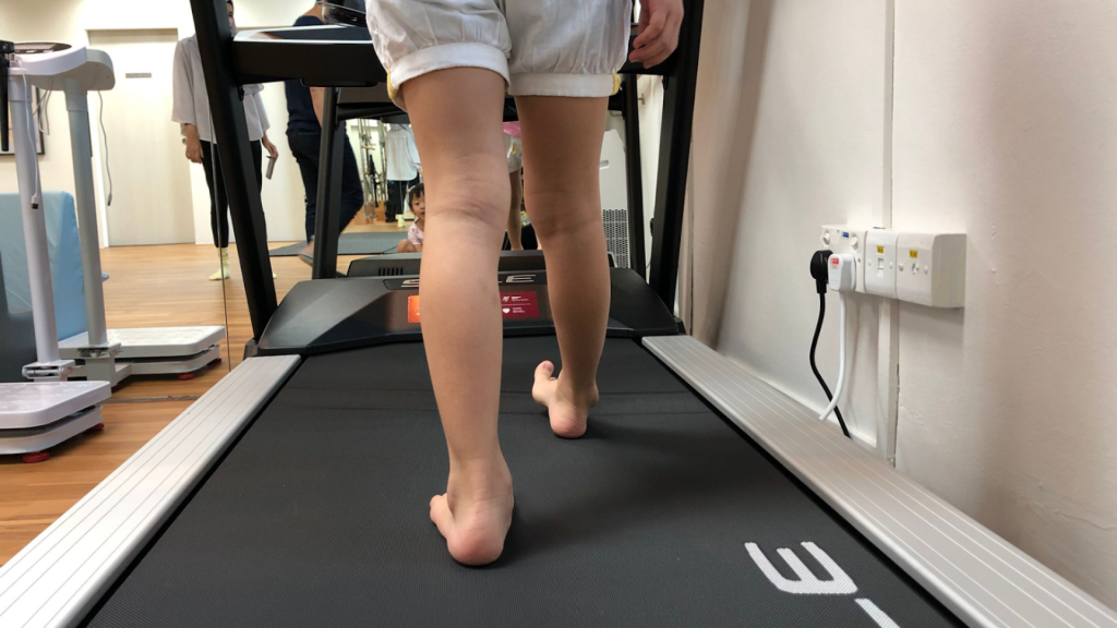 Child walking barefoot on a treadmill while clinicians observe lower limb alignment and gait pattern.