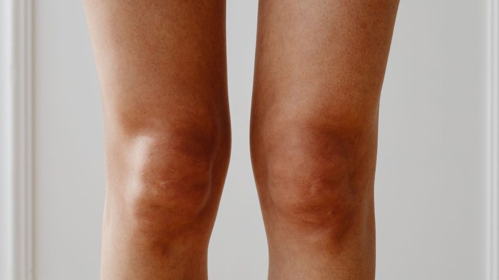 Close-up of knees showing lower limb alignment that may be linked to children feet problems