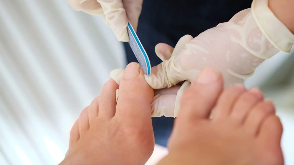 Medical pedicure nail filing performed by a clinician using gloves and sterile tools

