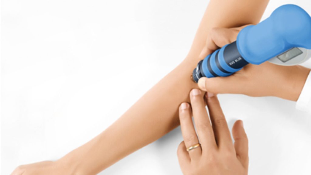 Physiotherapist applying shockwave therapy to a patient’s forearm using a handheld device, targeting localised tendon pain as part of evidence-based physiotherapy treatment.