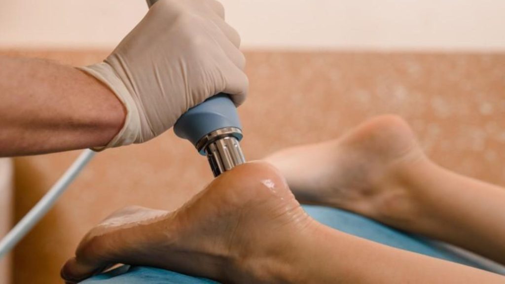 Physiotherapist performing shockwave therapy on the heel to treat plantar fasciitis, supporting tissue healing alongside active rehabilitation