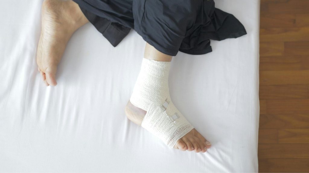 Bandaged ankle resting on a bed, illustrating ankle sprain and ongoing instability affecting running performance