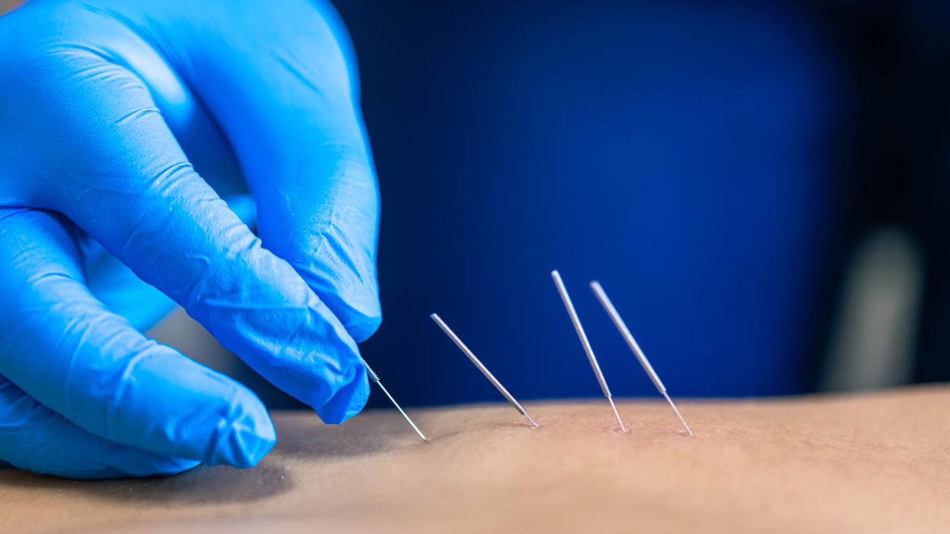 Physiotherapist performing hands-on massage therapy on a patient’s leg to relieve muscle tension and improve circulation as part of physiotherapy care.