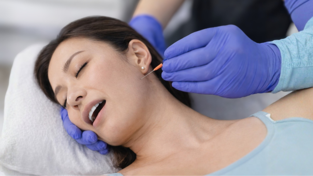 Dry needling therapy applied to the jaw muscle to treat temporomandibular joint pain.
