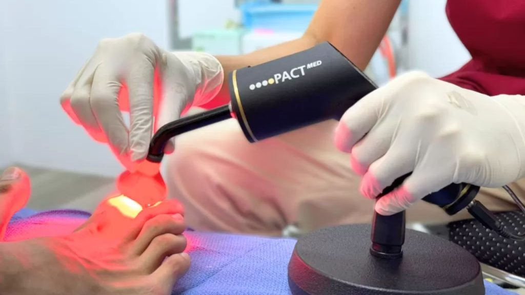 PACT light therapy session for child nail fungus treatment at Singapore podiatry clinic