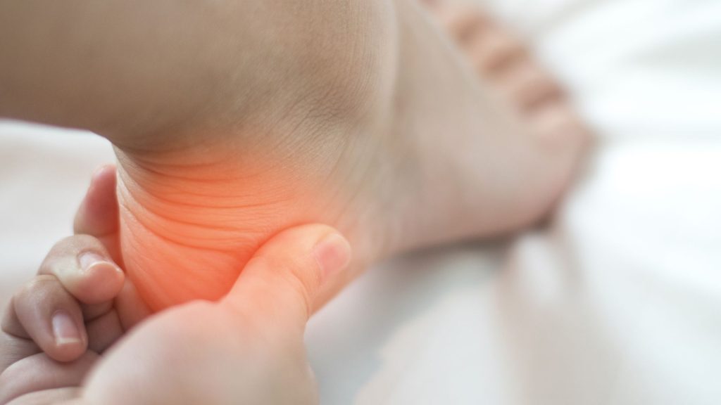 child heel pain highlighted in red possibly linked to Sever’s disease or growth-related heel pain in children